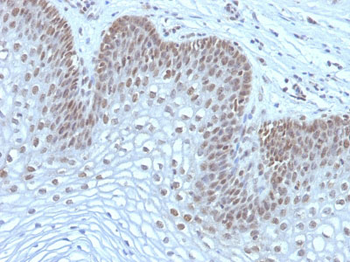 MAP3K1 (Mitogen-Activated Protein Kinase Kinase Kinase 1) Antibody - With BSA and Azide