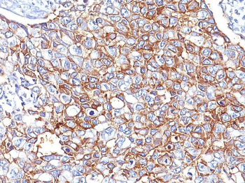 Ep-CAM / CD326 (Epithelial Marker) Antibody - With BSA and Azide