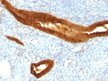 Ep-CAM / CD326 (Epithelial Marker) Antibody - With BSA and Azide