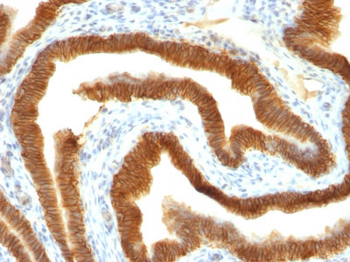 Ep-CAM / CD326 (Epithelial Marker) Antibody - With BSA and Azide