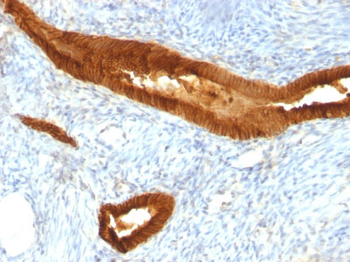 Ep-CAM / CD326 (Epithelial Marker) Antibody - With BSA and Azide