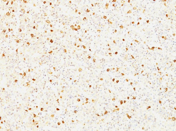 LH-beta (Luteinizing Hormone-beta) Antibody - With BSA and Azide