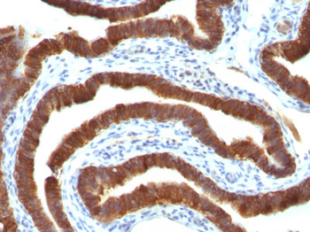 Cytokeratin 19 (KRT19) (Pancreatic Stem Cell Marker) Antibody - With BSA and Azide