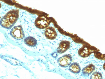 Cytokeratin 19 (KRT19) (Pancreatic Stem Cell Marker) Antibody - With BSA and Azide
