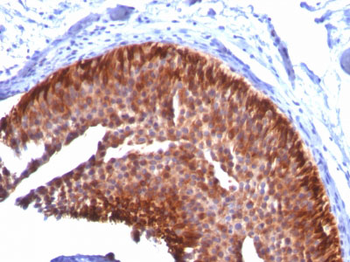 Cytokeratin 17 (KRT17) (Basal Epithelial Marker) Antibody - With BSA and Azide