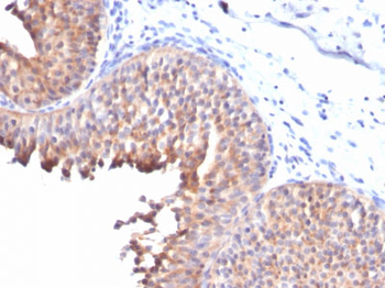 Cytokeratin 10 (KRT10) (Suprabasal Epithelial Marker) Antibody - With BSA and Azide