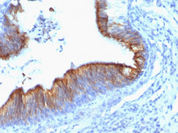Cytokeratin 8 (KRT8) Antibody - With BSA and Azide