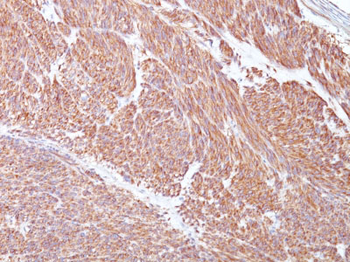 CD117 / c-Kit (Marker for Gastrointestinal Stromal Tumors) Antibody - With BSA and Azide