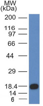 CD117 / c-Kit (Marker for Gastrointestinal Stromal Tumors) Antibody - With BSA and Azide