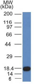 CD117 / c-Kit (Marker for Gastrointestinal Stromal Tumors) Antibody - With BSA and Azide
