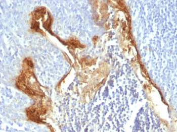 Involucrin (Squamous Cell Terminal Differentiation Marker) Antibody - With BSA and Azide