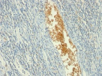 AMP Deaminase, Isoform E (AMPD3) (Erythroid Marker) Antibody - With BSA and Azide