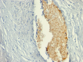 AMP Deaminase, Isoform E (AMPD3) (Erythroid Marker) Antibody - With BSA and Azide