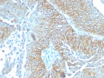 TRIM29 (Lung Squamous Cell Carcinoma Marker) Antibody - With BSA and Azide