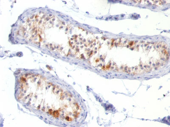 MART-1 / Melan-A / MLANA (Melanoma Marker) Antibody - With BSA and Azide