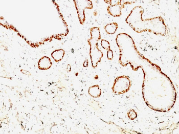 Calponin-1 (Smooth Muscle Marker) Antibody - With BSA and Azide
