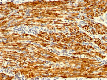 Calponin-1 (Smooth Muscle Marker) Antibody - With BSA and Azide