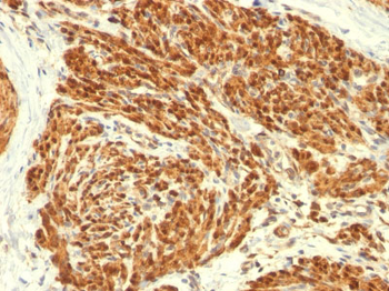 Calponin-1 (Smooth Muscle Marker) Antibody - With BSA and Azide