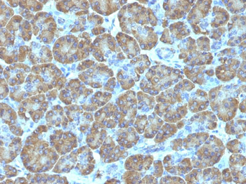 Topoisomerase (DNA) I, Mitochondrial (TOP1MT) Antibody - With BSA and Azide