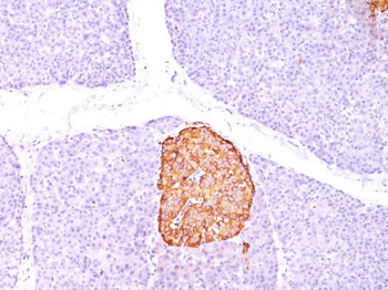 Chromogranin A / CHGA (Neuroendocrine Marker) Antibody - With BSA and Azide