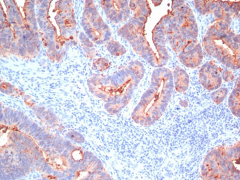 Carcinoembryonic Antigen, pan (CEA) / CD66 Antibody - With BSA and Azide