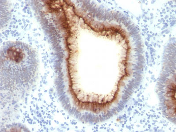 Carcinoembryonic Antigen (CEA) / CD66 Antibody - With BSA and Azide