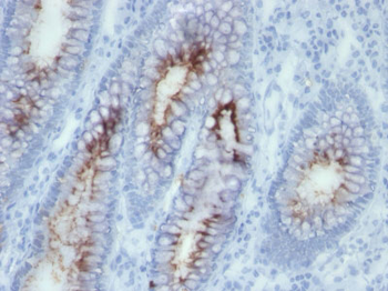 Carcinoembryonic Antigen (CEA) / CD66 Antibody - With BSA and Azide