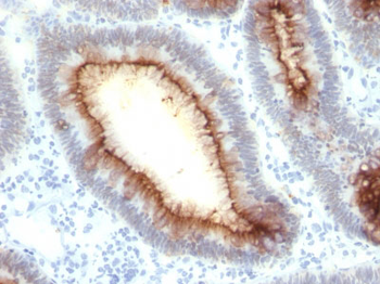 Carcinoembryonic Antigen (CEA) / CD66 Antibody - With BSA and Azide
