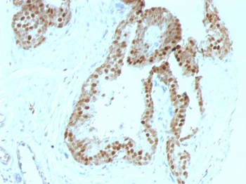 p57Kip2 (Mitotic Inhibitor/Suppressor Protein) Antibody - With BSA and Azide