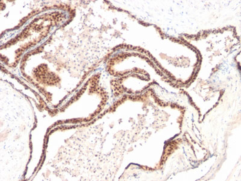 p27Kip1 (Mitotic Inhibitor/Suppressor Protein) Antibody - With BSA and Azide