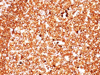 CD79a (B-Cell Marker) Antibody - With BSA and Azide