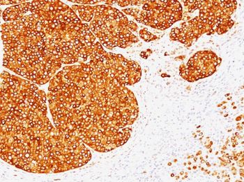 Tyrosinase (Melanoma Marker) Antibody - With BSA and Azide