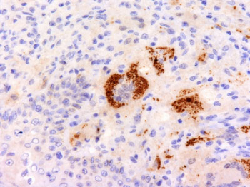 TNF-alpha (Tumor Necrosis Factor alpha) Antibody - With BSA and Azide