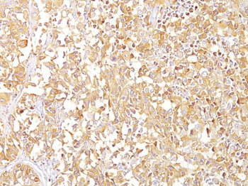gp100 / Melanosome / PMEL17 / SILV (Melanoma Marker) Antibody - With BSA and Azide