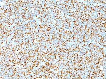 Cyclin D1 (G1-Cyclin & Mantle Cell Marker) Antibody - With BSA and Azide