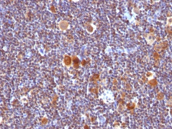 Bax (Apoptosis Marker) Antibody - With BSA and Azide