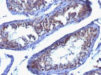 Prolactin Receptor (hPRL-Receptor) Antibody - With BSA and Azide