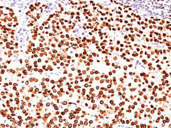Progesterone Receptor (Marker of Progestin Dependence) Antibody - With BSA and Azide
