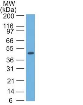 Cytokeratin 17 (KRT17) (Basal Epithelial Marker) Antibody - With BSA and Azide