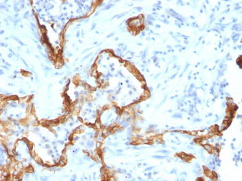 Cytokeratin 8 (KRT8) Antibody - With BSA and Azide