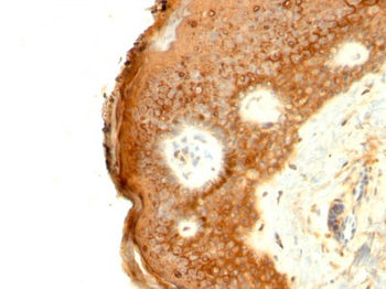 Involucrin (Squamous Cell Terminal Differentiation Marker) Antibody - With BSA and Azide