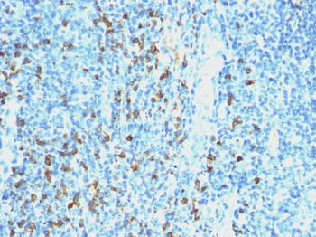 Lambda Light Chain (B-Cell Marker) Antibody - With BSA and Azide