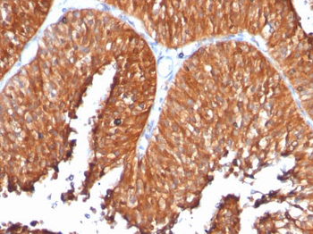 HSP60 (Heat Shock Protein 60) (Mitochondrial Marker) Antibody - With BSA and Azide