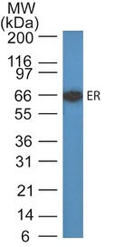Estrogen Receptor (Marker of Estrogen Dependence) Antibody - With BSA and Azide
