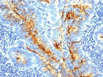 TAG-72 / CA72.4 (Tumor-Associated Glycoprotein) Antibody - With BSA and Azide