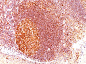 MALT1 (MALT-Lymphoma Marker) Antibody - With BSA and Azide