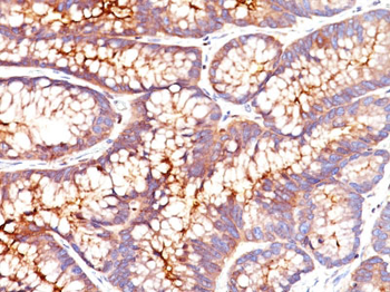 Carcinoembryonic Antigen (CEA) / CD66 Antibody - With BSA and Azide