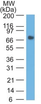 Carcinoembryonic Antigen (CEA) / CD66 Antibody - With BSA and Azide