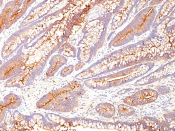 Carcinoembryonic Antigen (CEA) / CD66 Antibody - With BSA and Azide