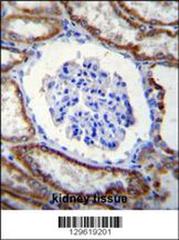 LRRC43 Antibody (N-term)